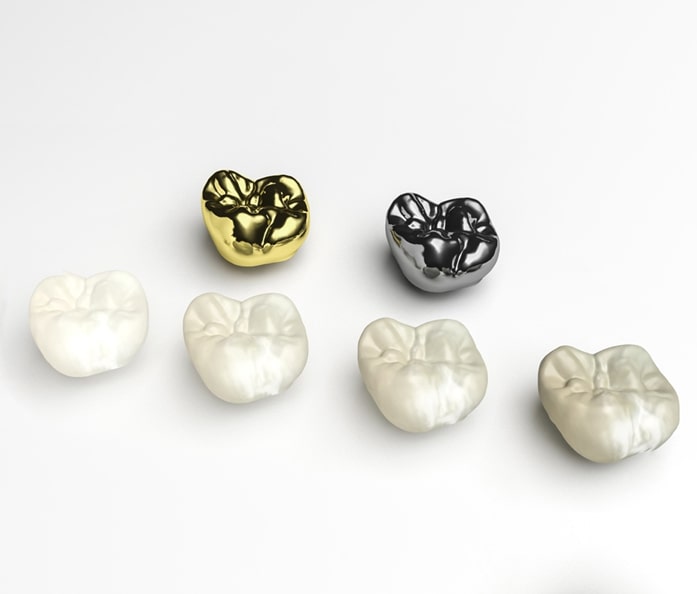 dental crowns in varsity